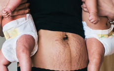5 Inspiring Photos Of Why Moms Should Be Proud Their Postpartum Stretch Marks